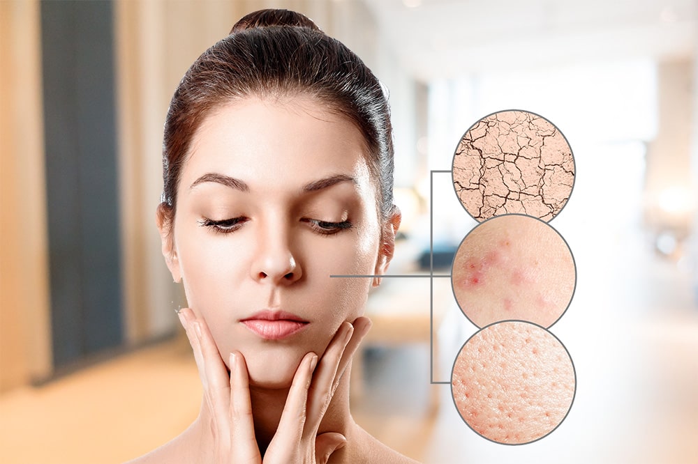 Tratamiento para la piel cuidado de la piel en Ambato-min