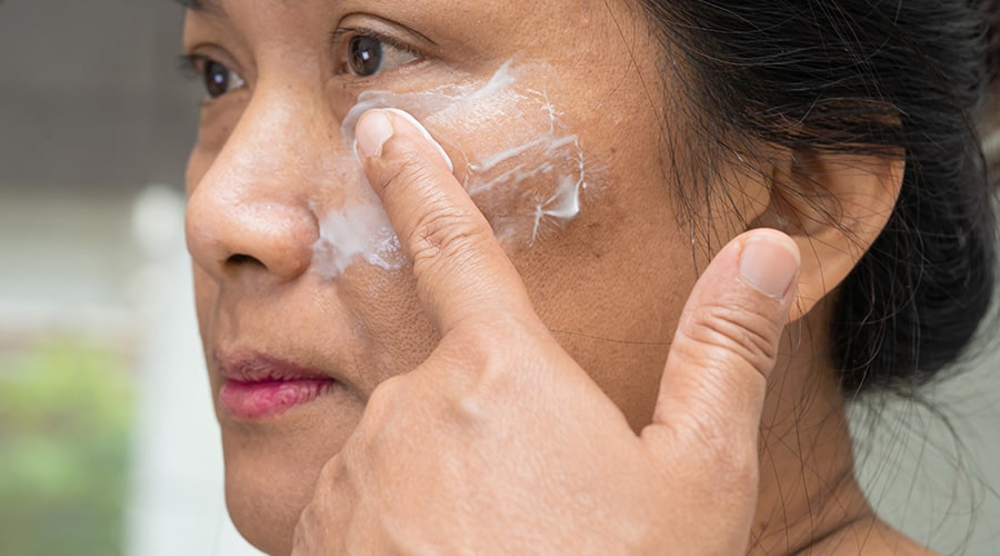 Manchas en la piel Ambato Melasma Tratamiento-min Manchas en la piel Ambato Melasma Tratamiento-min