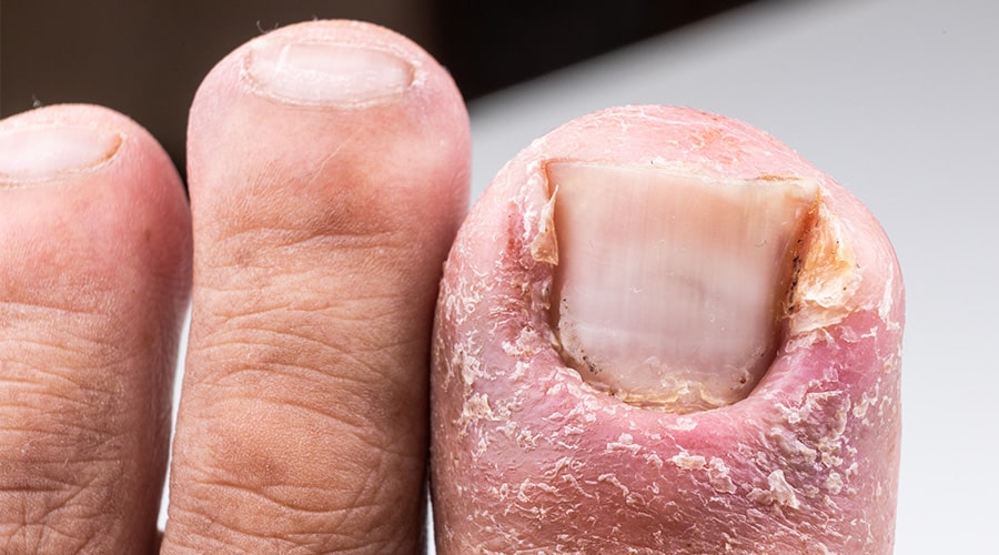 Tratamiento hongos ambato dermatólogo ambato3-min